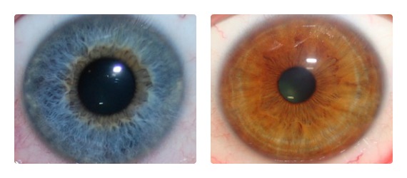 Iridology Assessments - Frequently Asked Questions - FAQ's ...